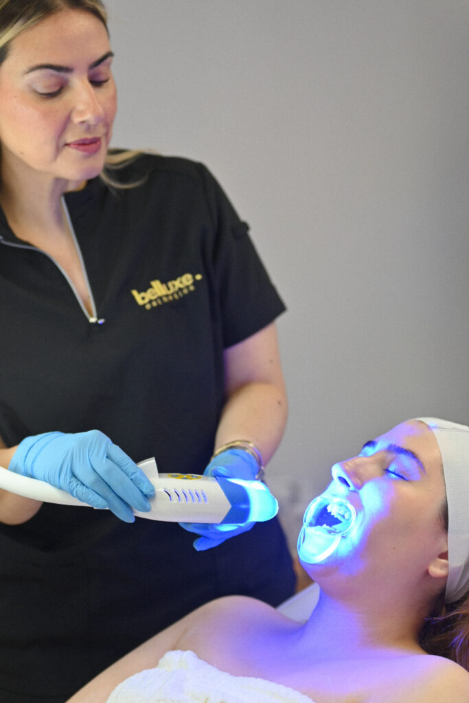 Blanqueamiento dental en Belluxe Esthetics - Spa de bienestar privado en Doral Florida