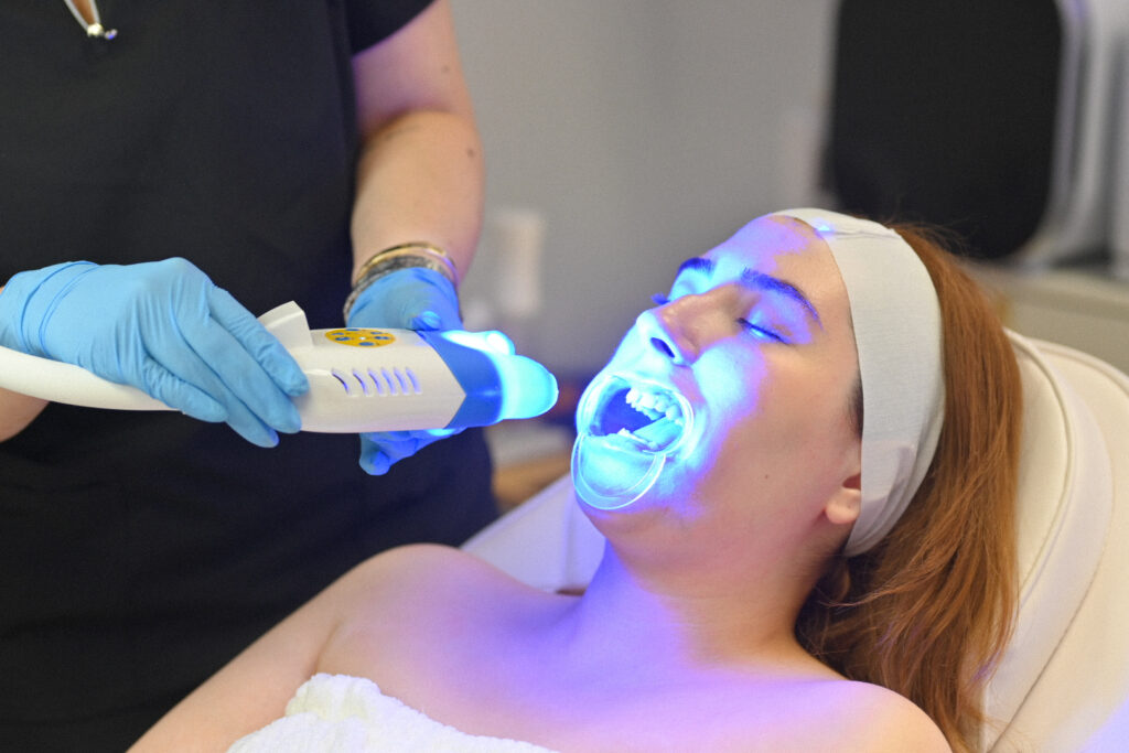 Blanqueamiento dental en Belluxe Esthetics - Spa de bienestar en Doral - Tratamientos de rejuvenecimiento facial